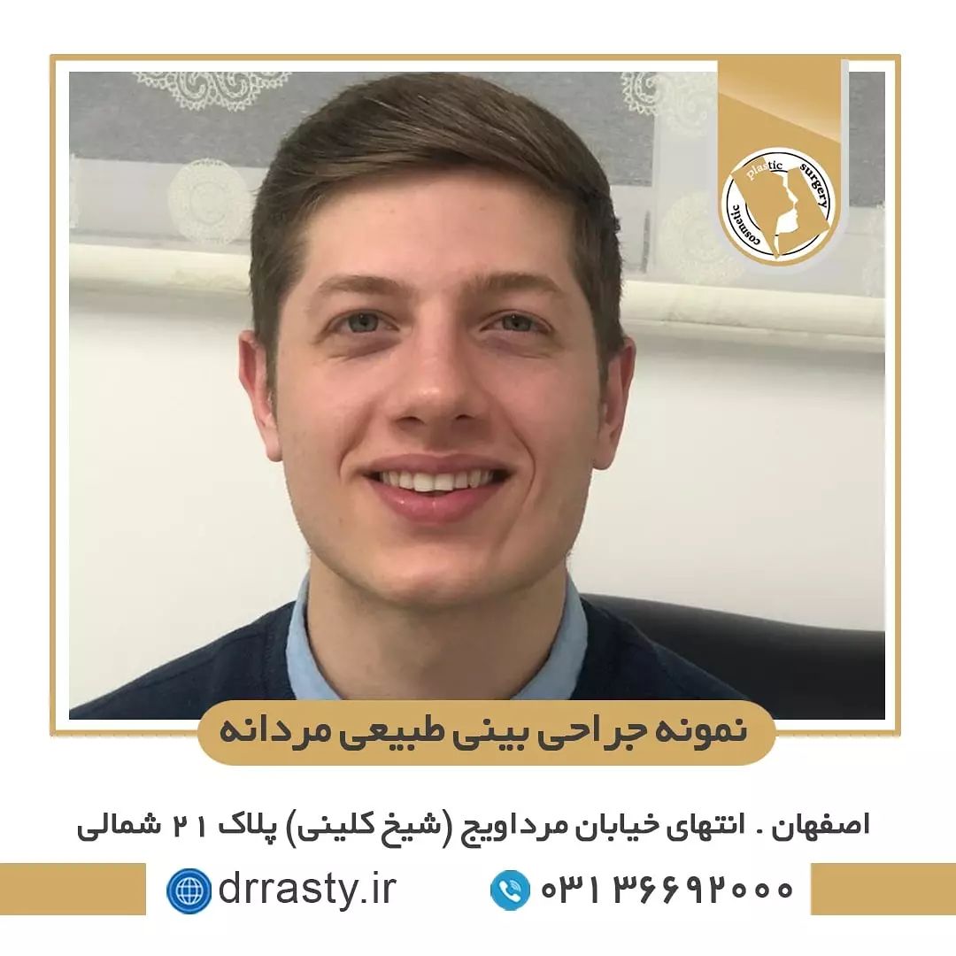 نمونه جراحی بینی طبیعی مردانه