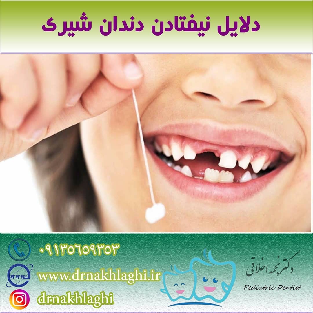 دلایل نیفتادن دندان شیری