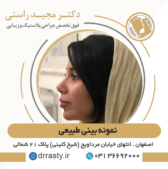 نمونه بینی طبیعی