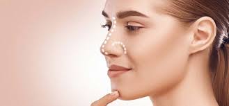 سوالات متداول بیماران درباره جراحی بینی در اصفهان